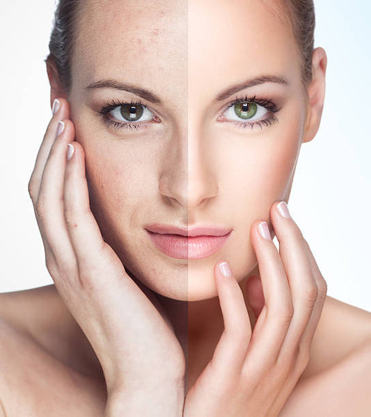 The Invisible Cost of Constant Skin Correction