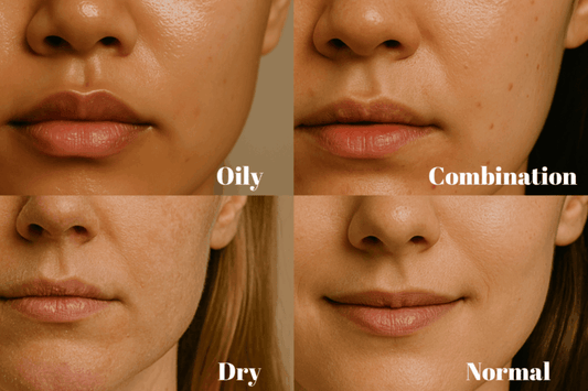 Why "Skin Type" Matters